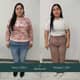 Slider image (10) Obesity Out Bariatric Surgery Center